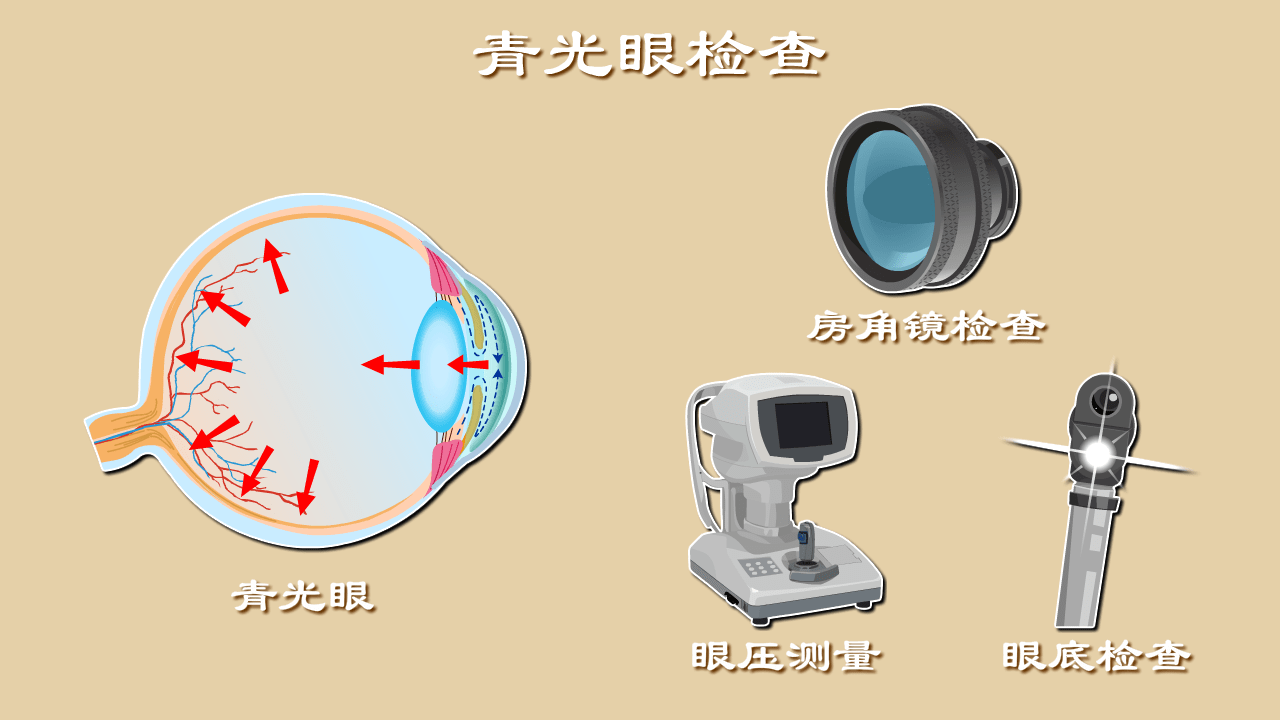 青光眼的最新消息，研究、治療與預防的新進展，青光眼研究、治療與預防的最新進展報道速遞