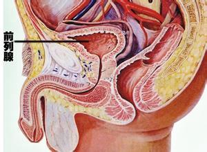 慢性前列腺炎的癥狀及其影響，慢性前列腺炎的癥狀及影響概述